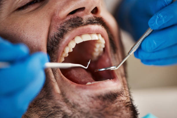 Best Emergency Dental Care for Sports Injuries in Weston, MO